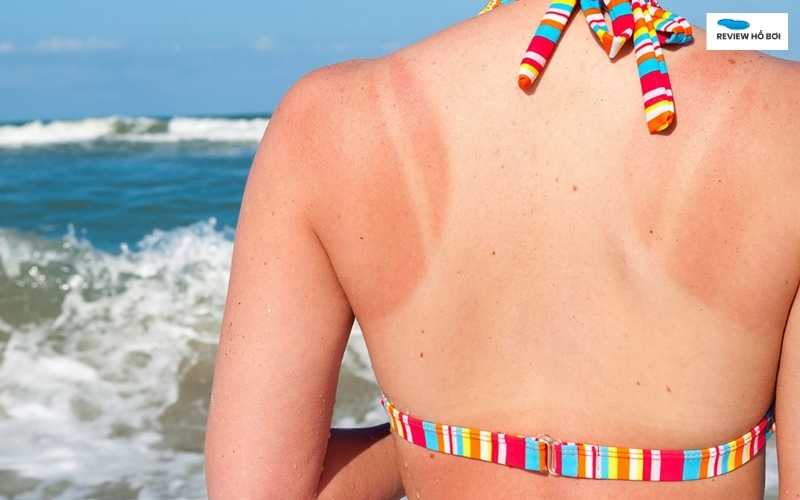 Nước hồ bơi có làm đen da không? Sự thật cần biết khi bơi Ánh sáng từ mặt trời có thể là nguyên nhân chính gây sạm da khi bơi