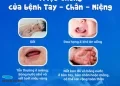 CẢNH BÁO ĐỎ: NGUY CƠ BÙNG PHÁT DỊCH BỆNH TẠI CÁC HỒ BƠI CÔNG CỘNG – BẢO VỆ SỨC KHỎE GIA ĐÌNH BẠN NGAY HÔM NAY