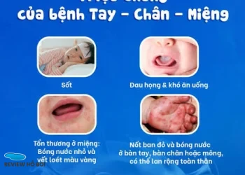 CẢNH BÁO ĐỎ: NGUY CƠ BÙNG PHÁT DỊCH BỆNH TẠI CÁC HỒ BƠI CÔNG CỘNG – BẢO VỆ SỨC KHỎE GIA ĐÌNH BẠN NGAY HÔM NAY CẢNH BÁO ĐỎ: NGUY CƠ BÙNG PHÁT DỊCH BỆNH TẠI CÁC HỒ BƠI CÔNG CỘNG – BẢO VỆ SỨC KHỎE GIA ĐÌNH BẠN NGAY HÔM NAY