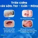 CẢNH BÁO ĐỎ: NGUY CƠ BÙNG PHÁT DỊCH BỆNH TẠI CÁC HỒ BƠI CÔNG CỘNG – BẢO VỆ SỨC KHỎE GIA ĐÌNH BẠN NGAY HÔM NAY CẢNH BÁO ĐỎ: NGUY CƠ BÙNG PHÁT DỊCH BỆNH TẠI CÁC HỒ BƠI CÔNG CỘNG – BẢO VỆ SỨC KHỎE GIA ĐÌNH BẠN NGAY HÔM NAY